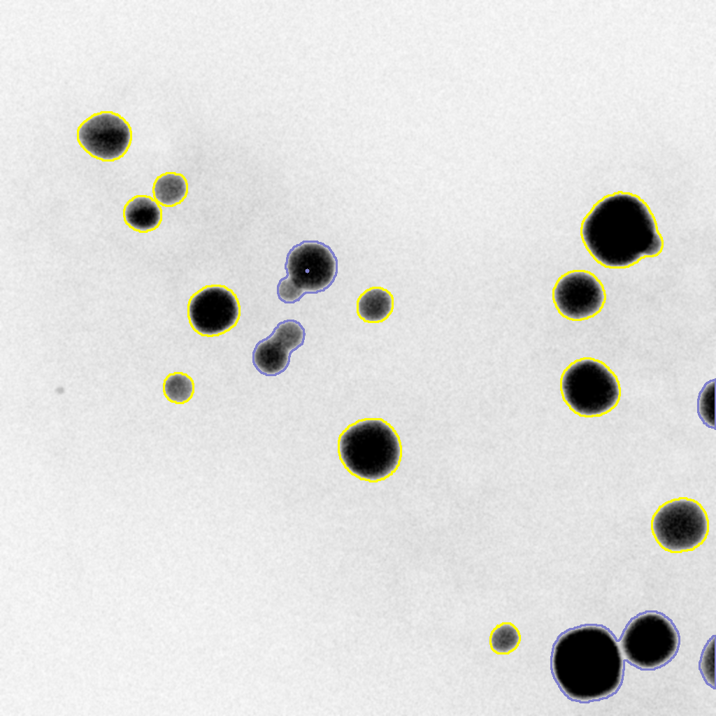 Detecting Particles ZoomIn Science